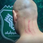 زخمی شدن مربی استقلال در پایان دیدار با خیبر +عکس