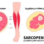 راهنمای کامل جلوگیری از تحلیل عضلانی | معرفی ۳ مکمل علمی HMB، اکدیسترون و بتا آلانین